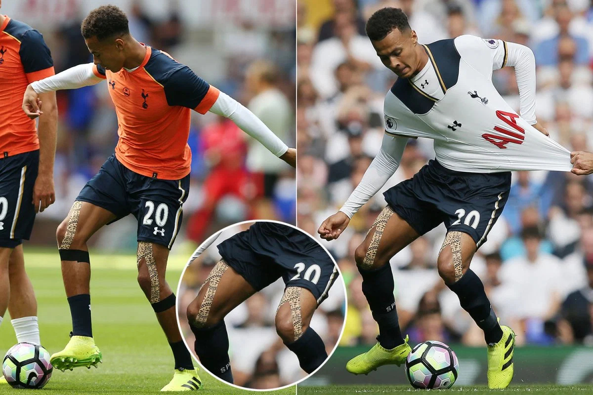 对足球运动员而言,双腿是运动损伤的重伤区,大腿肌肉,膝伤,小腿肌肉